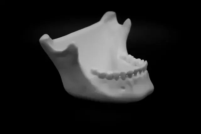 Tô Xương Hàm Người (Pre Supported) - Image 3
