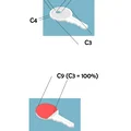 Ốp bọc khóa tham số (Parametric key cover) - Thumbnail 11