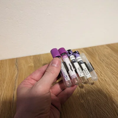 Khay giữ ống nghiệm y tế 3D (Sample Vial Holder) tiện lợi