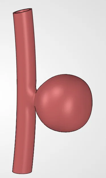 Mô hình 3D phình động mạch dạng túi (Saccular Aneurysm) giáo dục - Image 1