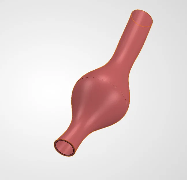 Mô hình phình động mạch hình thoi (Fusiform Aneurysm) in 3D - Image 1