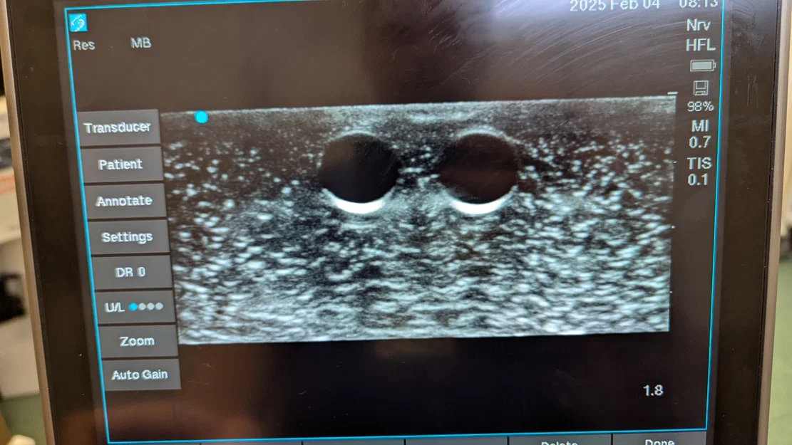 Phantom Cannula Siêu Âm (Ultrasound Cannula Phantom) - Image 6