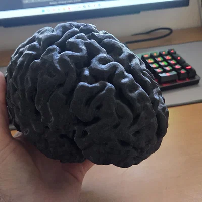 Mô hình 3D não bộ người được tạo từ dữ liệu quét MRI chi tiết