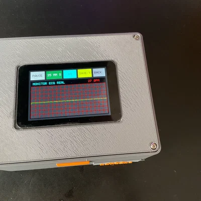 Hệ thống giám sát điện tâm đồ (ECG) hỗ trợ gửi Email và xuất dữ liệu ra PC