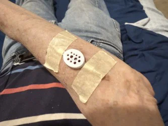 Tấm chắn bảo vệ vết phồng rộp (Skin Blister Shield) - Image 1
