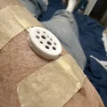 Tấm chắn bảo vệ vết phồng rộp (Skin Blister Shield) - Thumbnail 2