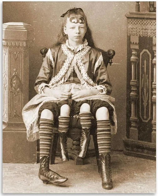 Mô hình 3D Josephine Myrtle Corbin - Cô gái bốn chân 1882 - Image 2