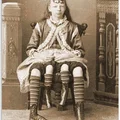 Mô hình 3D Josephine Myrtle Corbin - Cô gái bốn chân 1882 - Thumbnail 2