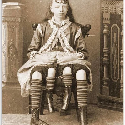 Mô hình 3D Josephine Myrtle Corbin - Cô gái bốn chân 1882
