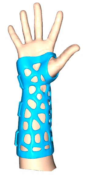 Nẹp Tùy Chỉnh Cho Bàn Tay, Cổ Tay & Ngón Cái - Image 1