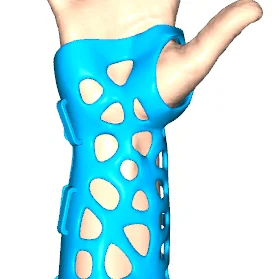 Nẹp Tùy Chỉnh Cho Bàn Tay, Cổ Tay & Ngón Cái