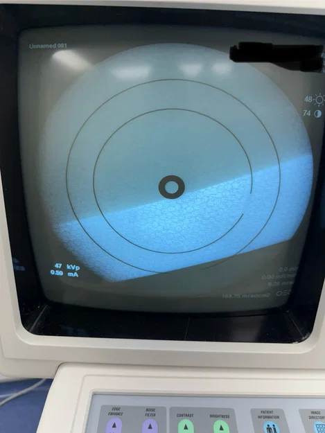 Khung lưới định cỡ OEC collimator - Image 2