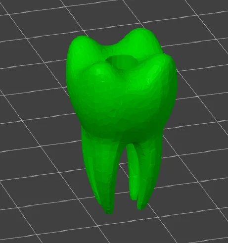 Mô hình hạt trang trí hình răng hàm (Molar Dental Bead) in 3D - Image 1