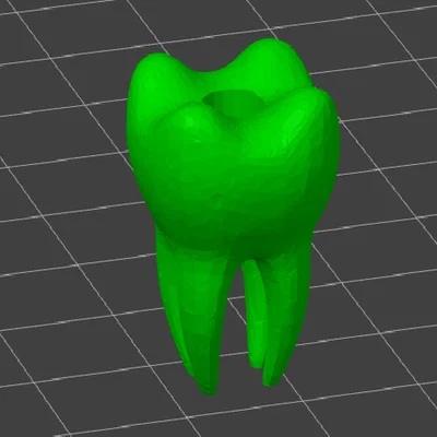 Mô hình hạt trang trí hình răng hàm (Molar Dental Bead) in 3D