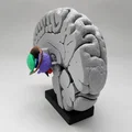 Mô hình Hạch nền (Basal Ganglia) và các nhân sâu trong não - Thumbnail 3