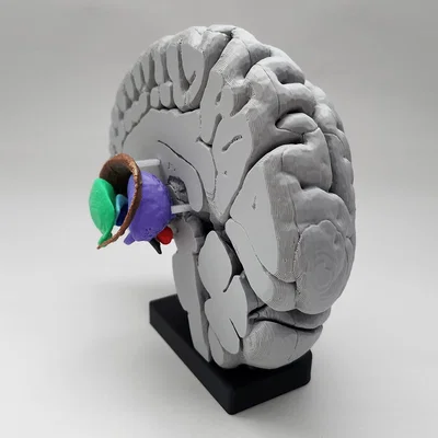 Mô hình Hạch nền (Basal Ganglia) và các nhân sâu trong não