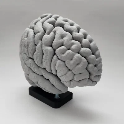Mô hình Hạch nền (Basal Ganglia) và các nhân sâu trong não
