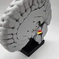 Mô hình Hạch nền (Basal Ganglia) và các nhân sâu trong não - Thumbnail 11