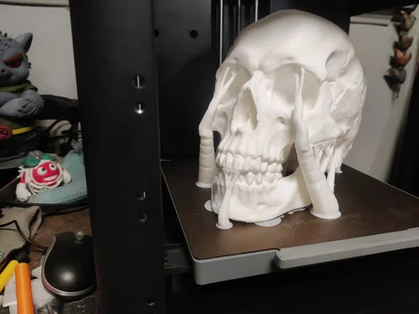 Mô hình hộp sọ Abraham Lincoln (AB-Skull) - File in 3D lịch sử - Image 1