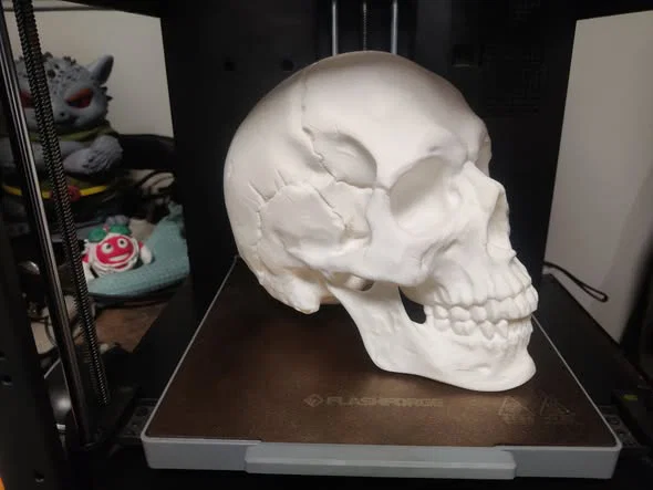 Mô hình hộp sọ Abraham Lincoln (AB-Skull) - File in 3D lịch sử - Image 2