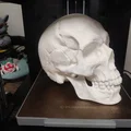 Mô hình hộp sọ Abraham Lincoln (AB-Skull) - File in 3D lịch sử - Thumbnail 2