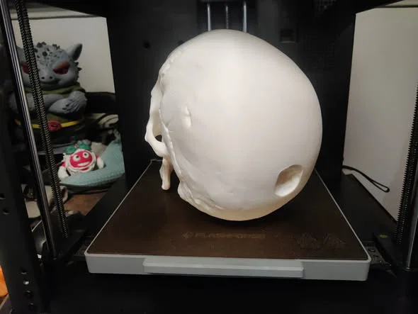 Mô hình hộp sọ Abraham Lincoln (AB-Skull) - File in 3D lịch sử - Image 3
